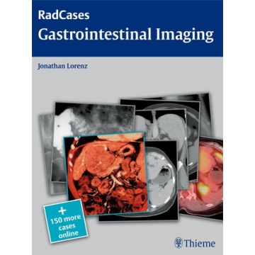 Gastrointestinal Imaging  Lorenz Jonathan M.  Thieme Medical Publishers  9781604061833