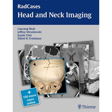 RadCases Head and Neck Imaging   [Gaurang - Thieme]
