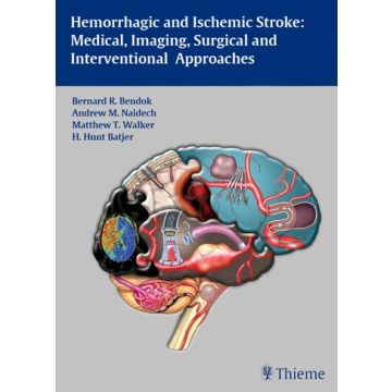 Hemorrhagic and Ischemic Stroke. Medical, Imaging, Surgical and Interventional Approaches  Bendok Bernard R.; Naidech Andrew M.; Walker Matthew T.; Batjer H. Hunt  Thieme Medical Publishers  9781604062342