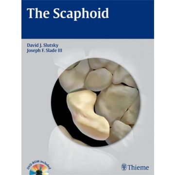 The Scaphoid  Slutsky David J.; Slade Joseph F.  Thieme Medical Publishers  9781604062373