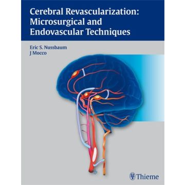 Cerebral Revascularization: Microsurgical and Endovascular Techniques  Nussbaum Eric; Mocco J  Thieme Medical Publishers  9781604062632