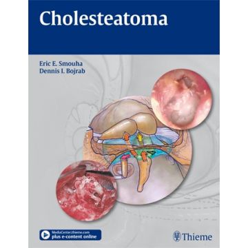 Cholesteatoma   Smouha Eric E.; Bojrab Dennis I.  Thieme Medical Publishers  9781604062779
