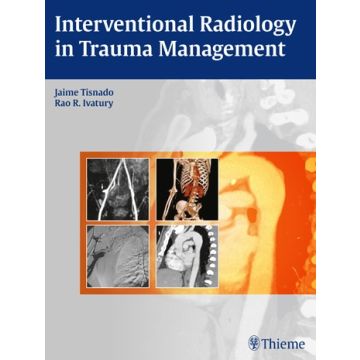 Interventional Radiology in Trauma Management  Tisnado Jaime; Ivatury Rao R.  Thieme  9781604063110