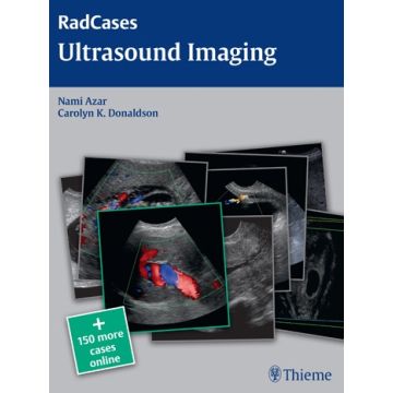 Ultrasound Imaging  Azar Nami R.; Donaldson Carolyn  Thieme Medical Publishers  9781604063226