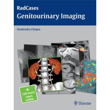 Genitourinary Imaging  Chopra Shailendra  Thieme Medical Publishers  9781604063240