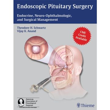 Endoscopic Pituitary Surgery. Endocrine, Neuro-Ophthalmologic, and Surgical Management  Schwartz Theodore H.; Anand Vijay K.  Thieme Medical Publishers  9781604063479