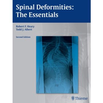 Spinal Deformities. The Essentials, 2/ed.  Heary Robert F.; Albert Todd J.  Thieme Medical Publishers  9781604064117