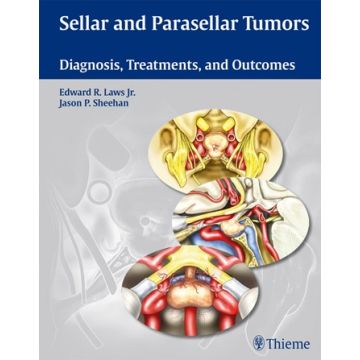 Sellar and Parasellar Tumors. Diagnosis, Treatments, and Outcomes  Laws Edward R.; Sheehan Jason P.  Thieme Medical Publishers  9781604064216