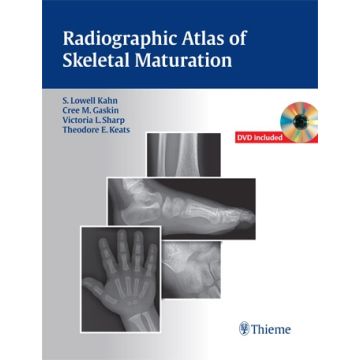 Radiographic Atlas of Skeletal Maturation  Kahn S. Lowell; Gaskin Christopher M.; Sharp Victoria L.; Keats Theodore E.; Li Bing  Thieme Medical Publishers  9781604065718