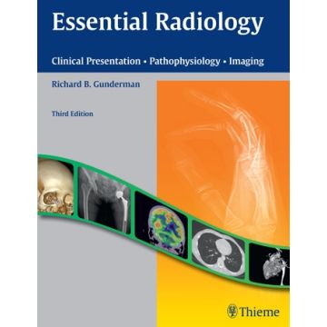 Essential Radiology. Clinical Presentation - Pathophysiology - Imaging  Gunderman Richard B.  Thieme Medical Publishers  9781604065732