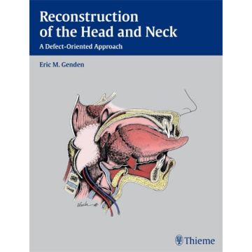 Reconstruction of the Head and Neck. A Defect-Oriented Approach  Genden Eric M.  Thieme Medical Publishers  9781604065763