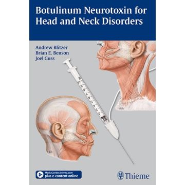 Botulinum Neurotoxin for Head and Neck Disorders  Blitzer Andrew; Benson Brian E.; Guss Joel  Thieme Medical Publishers  9781604065855