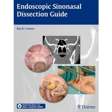 Endoscopic Sinonasal Dissection Guide  Casiano Roy R.  Thieme Medical Publishers  9781604065879