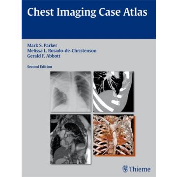 Chest Imaging Case Atlas  Parker Mark S.; Abbott Gerald F.; Rosado-de-Christenson Melissa L.  Thieme Medical Publishers  9781604065909