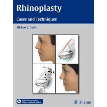 Rhinoplasty. Cases and Techniques Cases and Techniques  Godin Michael S.  Thieme Medical Publishers  9781604066807