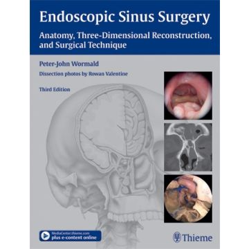 Endoscopic Sinus Surgery. Anatomy, Three-Dimensional Reconstruction, and Surgical Technique  Wormald Peter-John  Thieme Medical Publishers  9781604066876
