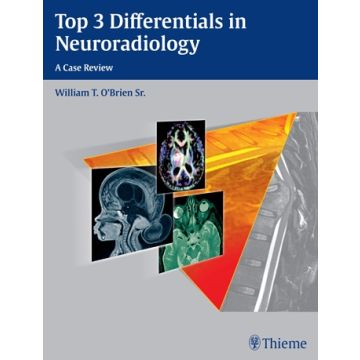 Top 3 Differentials in Neuroradiology  O'Brien William T.  Thieme Medical Publishers  9781604067231