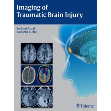 Imaging of Traumatic Brain Injury  Anzai Yoshimi; Fink Kathleen R.  Thieme Medical Publishers  9781604067286