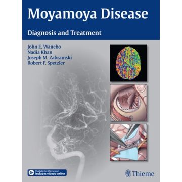 Moyamoya Disease. Diagnosis and Treatment  Wanebo John E.; Khan Nadia; Zabramski Joseph M.; Spetzler Robert F.  Thieme Medical Publishers  9781604067309