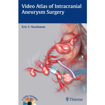 Video Atlas of Intracranial Aneurysm Surgery  Nussbaum Eric  Thieme Medical Publishers  9781604067385