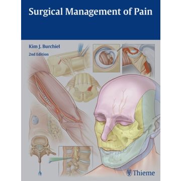 Surgical Management of Pain, 2/ed.  Burchiel Kim J.  Thieme Medical Publishers  9781604067514