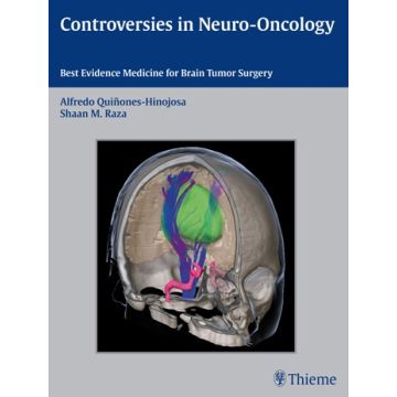 Controversies in Neuro-Oncology. Best Evidence Medicine for Brain Tumor Surgery  Quinones-Hinojosa Alfredo; Raza Shaan M.; Laws Edward R.  Thieme Medical Publishers  9781604067552