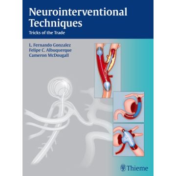 Neurointerventional Techniques. Tricks of the Trade  Gonzalez Fernando L.; Albuquerque Felipe C.; Mcdougall Cameron G.  Thieme Medical Publishers  9781604067576