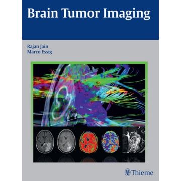 Brain Tumor Imaging  Jain Rajan; Essig Marco  Thieme  9781604068061