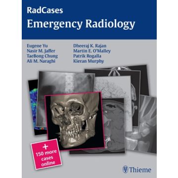Emergency Radiology  Yu Eugene; Jaffer Nasir; Chung Taebong; Naraghi Ali M.; Rajan Dheeraj; Murphy Kieran; O'Malley Martin; Rogalla Patrik  Thieme Medical Publishers  9781604068320