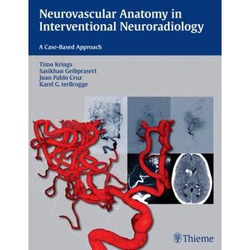 Neurovascular Anatomy in Interventional Neuroradiology. A Case-Based Approach  Krings Timo; Geibprasert Sasikhan; Cruz Juan Pablo; Ter Brugge Karel  Thieme Medical Publishers  9781604068399