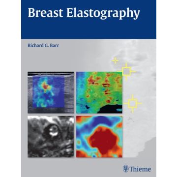 Breast Elastography  Barr Richard G.  Thieme Medical Publishers  9781604068528