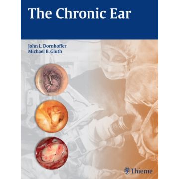 The Chronic Ear  Dornhoffer John L.; Michael B. Gluth   Thieme Medical Publishers  9781604068641
