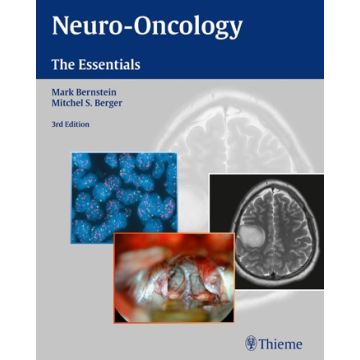 Neuro-Oncology: The Essentials, 3/ed.  Bernstein Mark; Berger Mitchel S.  Thieme Medical Publishers  9781604068832