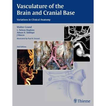 Vasculature of the Brain and Cranial Base. Variations in Clinical Anatomy, 2/ed.   Grand Walter; Hopkins L. Nelson; Siddiqui Adnan H.; Mocco J  Thieme Medical Publishers  9781604068856