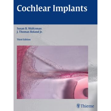 Cochlear Implants  Waltzman Susan B.; Roland J. Thomas  Thieme Medical Publishers  9781604069037