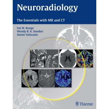 Neuroradiology. The Essentials with MR and CT  Runge Val M.; Smoker Wendy R. K.; Valavanis Antonios  Thieme Medical Publishers  9781604069167
