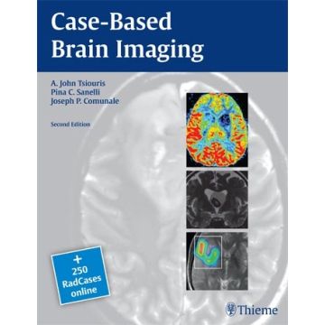 Case-Based Brain Imaging  Tsiouris A. John; Comunale Joseph P.; Sanelli Pina C.  Thieme Medical Publishers  9781604069532