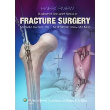 Harborview Illustrated Tips and Tricks in Fracture Surgery  Gardner Michael J.; Dunbar Robert; Henley M. Bradford; Nork Sean  LIPPINCOTT Williams and Wilkins  9781605470559