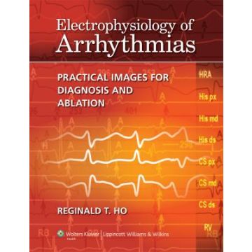 Electrophysiology of Arrhythmias  Ho Reginald T.  LIPPINCOTT Williams and Wilkins  9781605475905