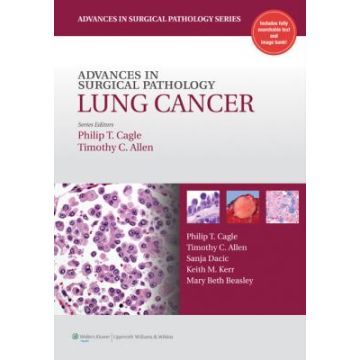 Advances in Surgical Pathology: Lung Cancer  Cagle Philip T.; Allen Timothy  LIPPINCOTT Williams and Wilkins  9781605475912