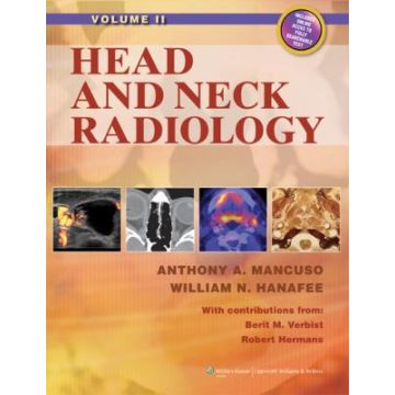 Head and Neck Radiology  Mancuso Anthony A.  LIPPINCOTT Williams and Wilkins  9781605477152