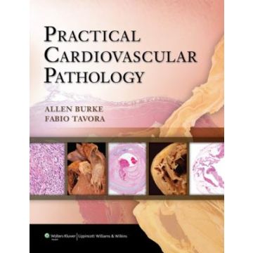Practical Cardiovascular Pathology  Burke Allen P.; Tavora Fabio  LIPPINCOTT Williams and Wilkins  9781605478418