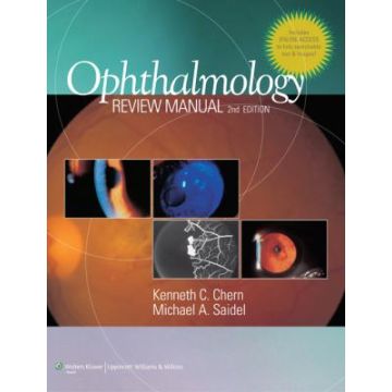 Ophthalmology Review Manual, 2ed.  Chern Kenneth C.; Saidel Michael A.  LIPPINCOTT Williams and Wilkins  9781608310074