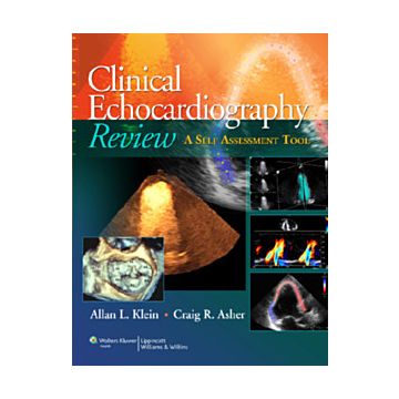 Clinical Echocardiography Review  Klein Allan L.; Asher Craig R.  LIPPINCOTT Williams and Wilkins  9781608310548
