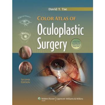 Color Atlas of Oculoplastic Surgery, 2ed.  Tse David T.  LIPPINCOTT Williams and Wilkins  9781608310784