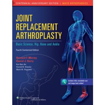 Joint Replacement Arthroplasty, 4ed.  Morrey Bernard F.; Berry Daniel J.; An Kai-Nan; Kitaoka Harold B.; Pagnano Mark W.  LIPPINCOTT Williams and Wilkins  9781608314706