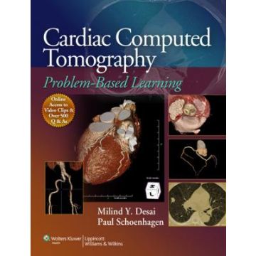 Cardiac Computed Tomography  Desai Milind Y.; Schoenhagen Paul  LIPPINCOTT Williams and Wilkins  9781608315659