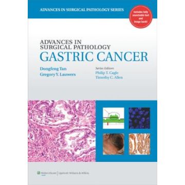 Advances in Surgical Pathology: Gastric Cancer  Tan Dongfeng; Lauwers Gregory  LIPPINCOTT Williams and Wilkins  9781608316175