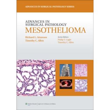 Advances in Surgical Pathology: Mesothelioma  Attanoos Richard L.; Allen Timothy C.  LIPPINCOTT Williams and Wilkins  9781608316182