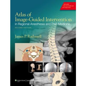 Atlas of Image-Guided Intervention in Regional Anesthesia and Pain Medicine, 2ed.  Rathmell James P.  LIPPINCOTT Williams and Wilkins  9781608317042